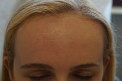 Close-up of a person's forehead and closed eyes, with blonde hair visible at the top of the image.