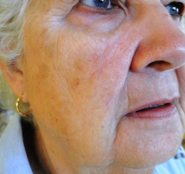 Close-up of an elderly person's face, showing wrinkles, light skin, blue eyes, and a gold earring. Only part of the right side of the face is visible.