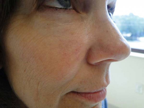 Close-up of the left side of a woman's face showing fine lines, wrinkles, and skin texture, with a window and trees visible in the blurred background.