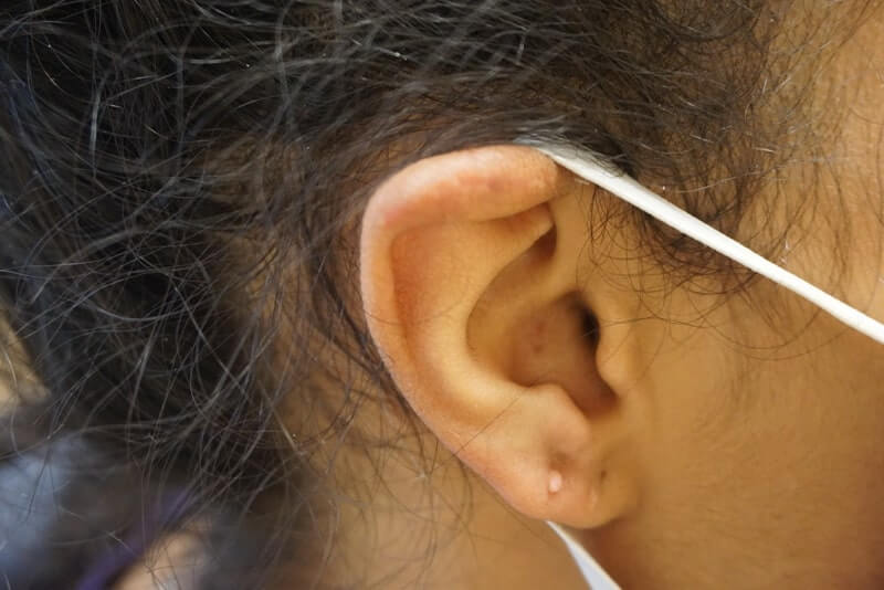Close-up of a person's ear with a white elastic mask strap resting on it; the person has dark hair pulled back.