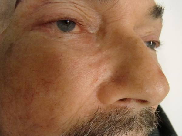 Close-up of an adult man's face showing his eye, nose, cheek, and part of his mustache and beard.
