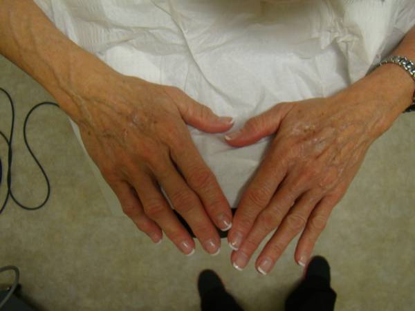 A pair of elderly hands with visible veins, age spots, and manicured nails rests on a white cloth surface.