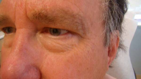 Close-up of the left side of a middle-aged man's face, showing his eye, eyebrow, and some wrinkles on the skin.