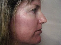 Side profile of a woman with light skin and blonde hair, facing to the right against a plain background.