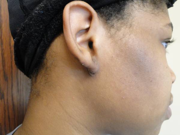 Close-up of the right side of a person's face and ear, showing short hair and wearing a black head covering.