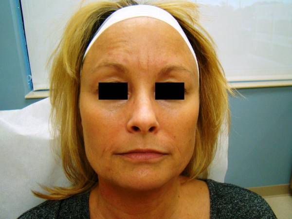A woman with shoulder-length blonde hair sits facing the camera, wearing a white headband. Her eyes are covered with black rectangles.