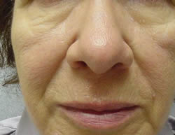 Close-up of the lower half of an older person's face, showing visible wrinkles and skin texture on the nose, cheeks, and mouth area.