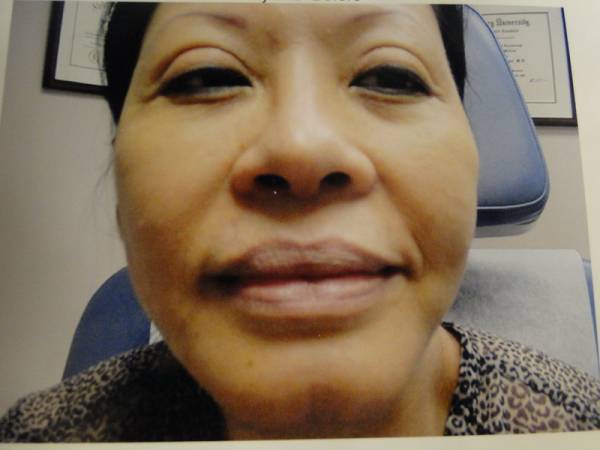 A close-up of a middle-aged woman sitting in a medical office chair, facing the camera, with certificates visible on the wall behind her.