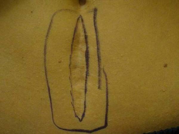 A piece of yellowish material with a vertical tear in the center, outlined with a thick black marker.