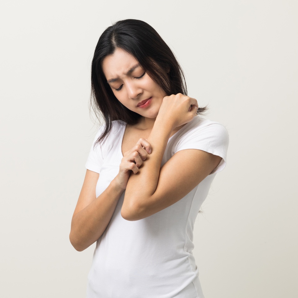 Asian women have skin problems She felt irritation on her skin. Skin infection itching red rash scratching with hands. She around 25 Wearing white shirt standing on isolate background