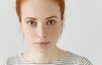A young person with red hair, light skin, and freckles looks directly at the camera. They are wearing a white and black striped shirt against a plain background.