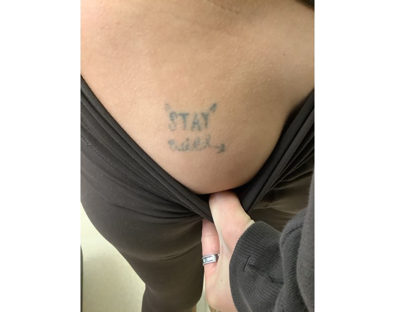 Tattoo Before removal photo